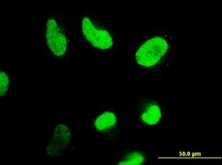 HDAC4, Mouse anti-Human, Clone: 2B11, Abnova 100&mu;g; Unconjugated:Antibodies,