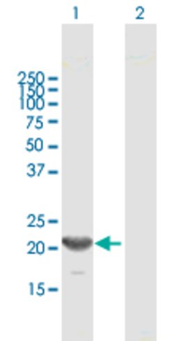 GINS1, Mouse anti-Human, Polyclonal Antibody, Abnova 50 &mu;g | Buy Online | Abnova | Fisher Scientific