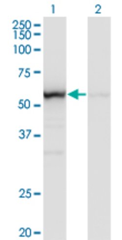 OXSR1, Mouse anti-Human, Clone: 1B10, Abnova 100&mu;g; Unconjugated:Antibodies,