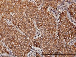 MVP, Mouse anti-Human, Clone: 2H3-1A6, Abnova 100&mu;g; Unconjugated:Antibodies,