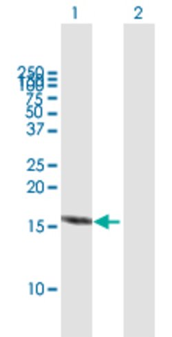 RBX1, Mouse anti-Human, Polyclonal Antibody, Abnova 50&mu;g; Unconjugated:Antibodies,