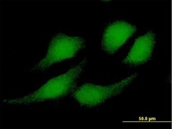 RBX1, Mouse anti-Human, Polyclonal Antibody, Abnova 50&mu;g; Unconjugated:Antibodies,