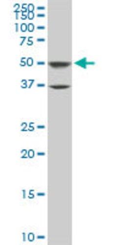 ROD1, Mouse anti-Human, Clone: 4C9, Abnova 100&mu;g; Unconjugated:Antibodies,