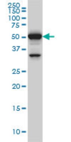 ROD1, Mouse anti-Human, Clone: 4C9, Abnova 100&mu;g; Unconjugated:Antibodies,