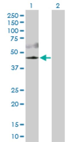 AKT3, Rabbit anti-Human, Polyclonal Antibody, Abnova 100&mu;g; Unconjugated:Antibodies,