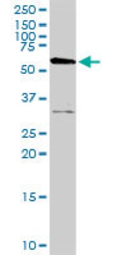 AKT3, Rabbit anti-Human, Polyclonal Antibody, Abnova 100&mu;g; Unconjugated:Antibodies,