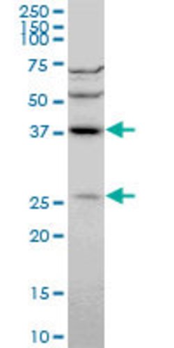 DNAJB6, Mouse anti-Human, Clone: 2C11-C1, Abnova 100&mu;g; Unconjugated:Antibodies,