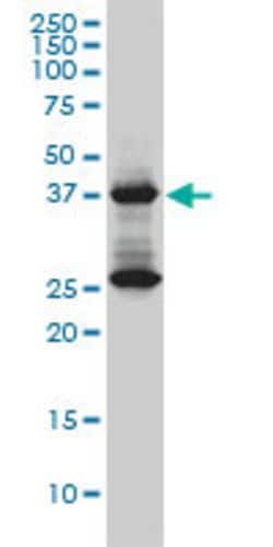 DNAJB6, Mouse anti-Human, Clone: 2C11-C1, Abnova 100&mu;g; Unconjugated:Antibodies,