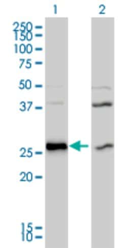 DNAJB6, Mouse anti-Human, Clone: 2C11-C1, Abnova 100&mu;g; Unconjugated:Antibodies,