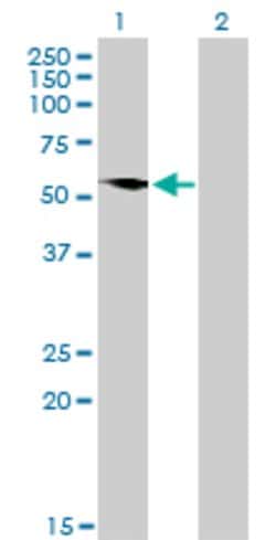 G3BP1, Mouse anti-Human, Clone: 2F3, Abnova 100&mu;g; Unconjugated:Antibodies,