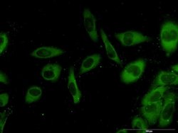 G3BP1, Mouse anti-Human, Clone: 2F3, Abnova 100&mu;g; Unconjugated:Antibodies,