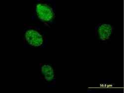 RBM5, Mouse anti-Human, Polyclonal Antibody, Abnova 50&mu;g; Unconjugated:Antibodies,