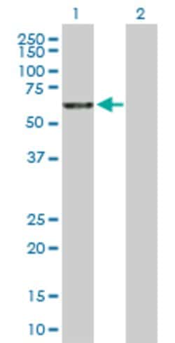 RBM5, Rabbit anti-Human, Polyclonal Antibody, Abnova 100&mu;g; Unconjugated:Antibodies,
