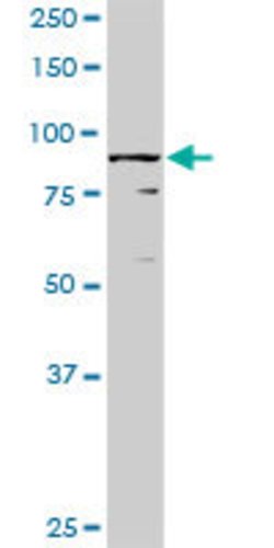 RBM5, Rabbit anti-Human, Polyclonal Antibody, Abnova 100&mu;g; Unconjugated:Antibodies,