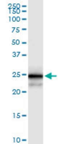 MPZL2, Rabbit anti-Human, Polyclonal Antibody, Abnova 100&mu;L; Unconjugated:Antibodies,