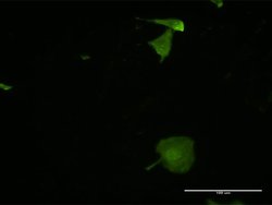 MPZL2, Mouse anti-Human, Clone: 2E10, Abnova 100&mu;g; Unconjugated:Antibodies,