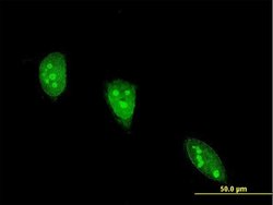ANGPTL7, Mouse anti-Human, Clone: 2C6, Abnova 100&mu;g; Unconjugated:Antibodies,