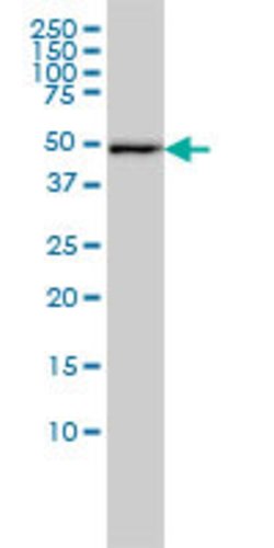 DNAJA2, Mouse anti-Human, Clone: 2A11-F2, Abnova 100&mu;g; Unconjugated:Antibodies,