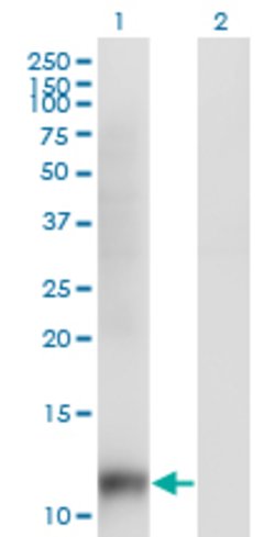 SNAPC5, Mouse anti-Human, Clone: 6G10, Abnova 100&mu;g; Unconjugated:Antibodies,