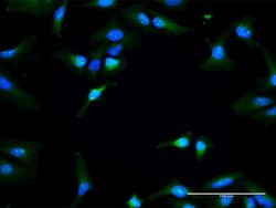 RAPGEF3, Rabbit anti-Human, Polyclonal Antibody, Abnova 100&mu;L; Unconjugated:Antibodies,