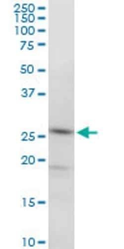 PGRMC2, Mouse anti-Human, Clone: 2A3, Abnova 100&mu;g; Unconjugated:Antibodies,