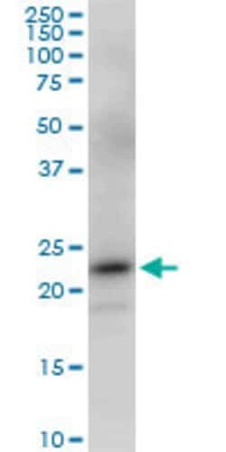 PGRMC2, Mouse anti-Human, Clone: 2A3, Abnova 100&mu;g; Unconjugated:Antibodies,