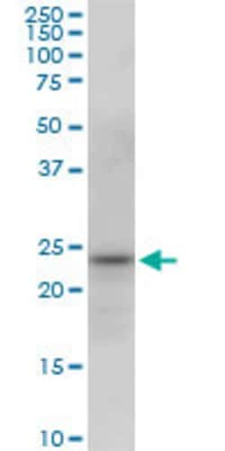 PGRMC2, Mouse anti-Human, Clone: 2A3, Abnova 100&mu;g; Unconjugated:Antibodies,