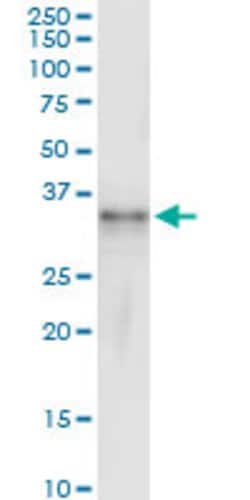 IFI30, Rabbit anti-Human, Polyclonal Antibody, Abnova 100&mu;L; Unconjugated:Antibodies,