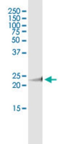 MAD2L2, Rabbit anti-Human, Polyclonal Antibody, Abnova 100&mu;L; Unconjugated:Antibodies,