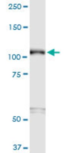 SEMA6B, Mouse anti-Human, Clone: 2H7, Abnova 100&mu;g; Unconjugated:Antibodies,