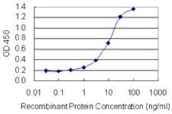 SEMA6B, Mouse anti-Human, Clone: 2H7, Abnova 100&mu;g; Unconjugated:Antibodies,