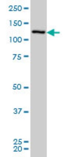 CHERP, Mouse anti-Human, Clone: 2H5, Abnova 50&mu;g; Unconjugated:Antibodies,