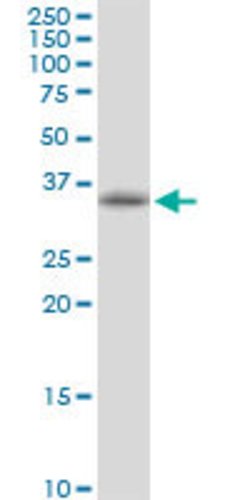 POLR3F, Mouse anti-Human, Polyclonal Antibody, Abnova 50 &mu;g | Buy Online | Abnova | Fisher Scientific
