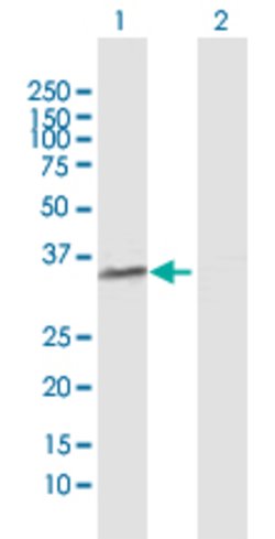 POLR3F, Rabbit anti-Human, Polyclonal Antibody, Abnova 100&mu;g; Unconjugated:Antibodies,