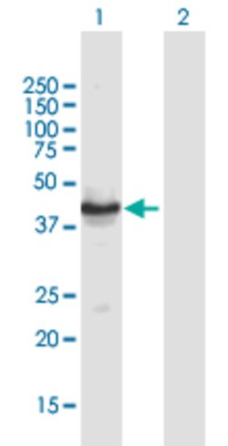 TUSC4, Mouse anti-Human, Polyclonal Antibody, Abnova 50&mu;g; Unconjugated:Antibodies,