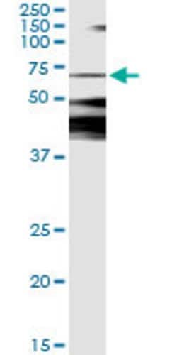 CAMKK2, Mouse anti-Human, Clone: 1A11, Abnova 100&mu;g; Unconjugated:Antibodies,