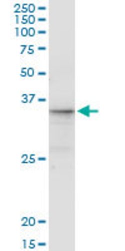 CGREF1, Mouse anti-Human, Clone: 2D7, Abnova 100&mu;g; Unconjugated:Antibodies,