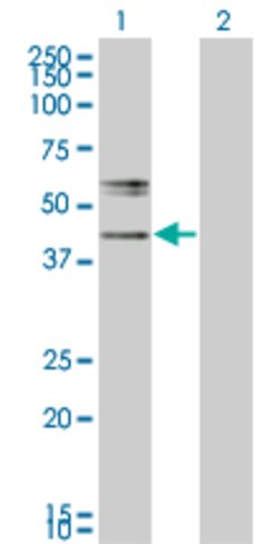 B3GNT2, Mouse anti-Human, Clone: 1A8, Abnova 100&mu;g; Unconjugated:Antibodies,