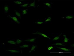 NFAT5, Mouse anti-Human, Polyclonal Antibody, Abnova 50&mu;g; Unconjugated:Antibodies,