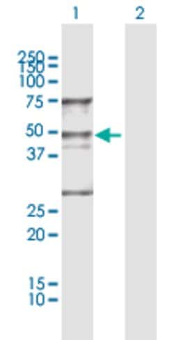 WDR4, Rabbit anti-Human, Polyclonal Antibody, Abnova 100 &mu;L | Buy Online | Abnova | Fisher Scientific