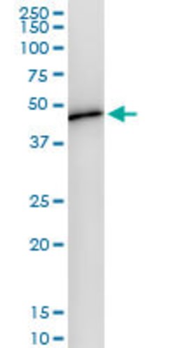 WDR4, Rabbit anti-Human, Polyclonal Antibody, Abnova 100 &mu;L | Buy Online | Abnova | Fisher Scientific