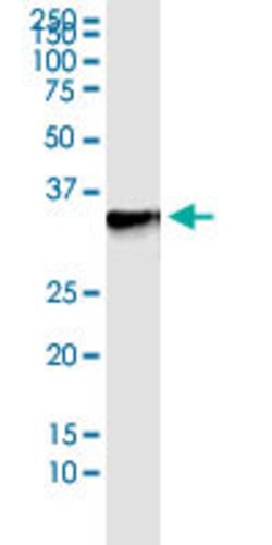 TOMM34, Rabbit anti-Human, Polyclonal Antibody, Abnova 100&mu;L; Unconjugated:Antibodies,