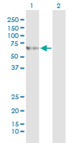 SLC27A5, Mouse anti-Human, Clone: 5A7, Abnova 100&mu;g; Unconjugated:Antibodies,