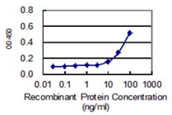 SLC27A5, Mouse anti-Human, Clone: 5A7, Abnova 100&mu;g; Unconjugated:Antibodies,