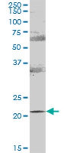 RAB31, Mouse anti-Human, Polyclonal Antibody, Abnova 50&mu;g; Unconjugated:Antibodies,