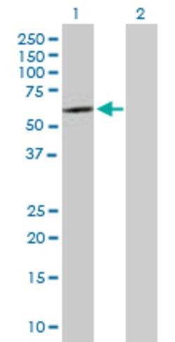 SOX30, Mouse anti-Human, Polyclonal Antibody, Abnova 50&mu;g; Unconjugated:Antibodies,