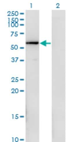 FGFR1OP, Mouse anti-Human, Clone: 1E8, Abnova 100&mu;g; Unconjugated:Antibodies,
