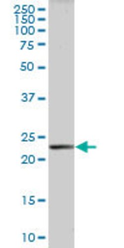 PLA2G16, Mouse anti-Human, Polyclonal Antibody, Abnova 50&mu;g; Unconjugated:Antibodies,
