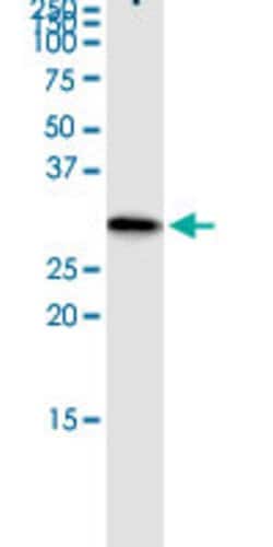 NUDT6, Rabbit anti-Human, Polyclonal Antibody, Abnova 100&mu;L; Unconjugated:Antibodies,