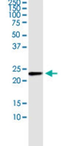 NUDT4, Rabbit anti-Human, Polyclonal Antibody, Abnova 100 &mu;L | Buy Online | Abnova | Fisher Scientific